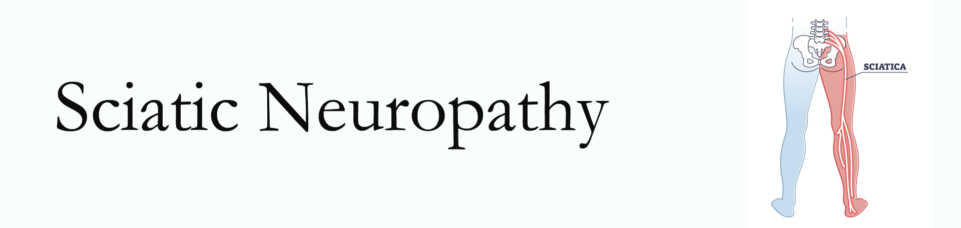 Augusta neuropathy pain (sciatica) 